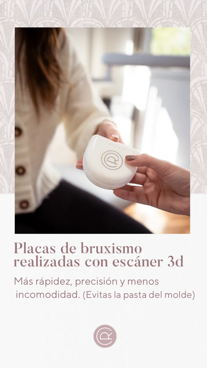 Story: Placas con escáner 3D